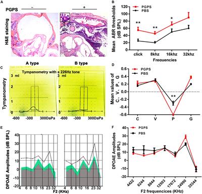 Role of Endoplasmic Reticulum Stress in Otitis Media